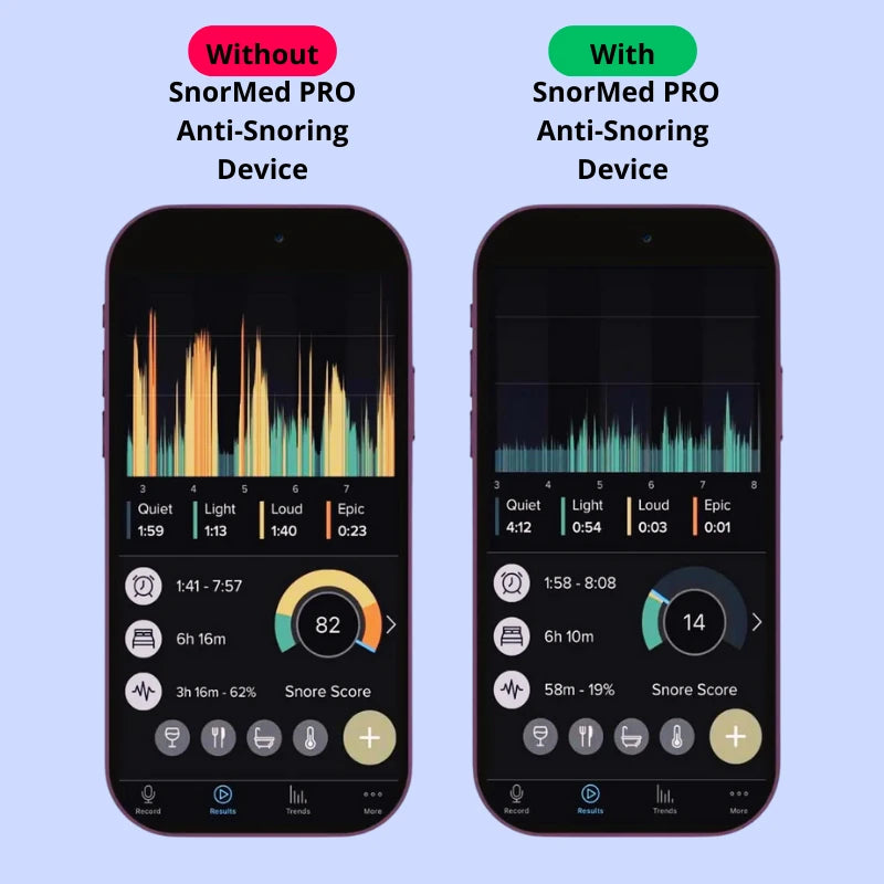 SnorMed™ PRO Anti-Snoring Device